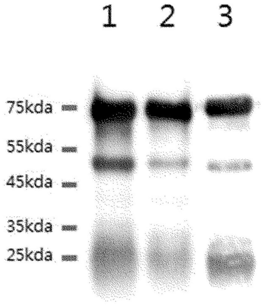Method for producing yolk antibody for prevention or treatment of obesity through cholesterol absorption inhibition