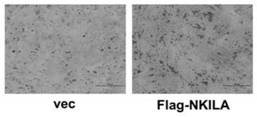 Application of long non-coding RNA-nkila in the repair of bone tissue damage