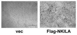 Application of long non-coding RNA-nkila in the repair of bone tissue damage