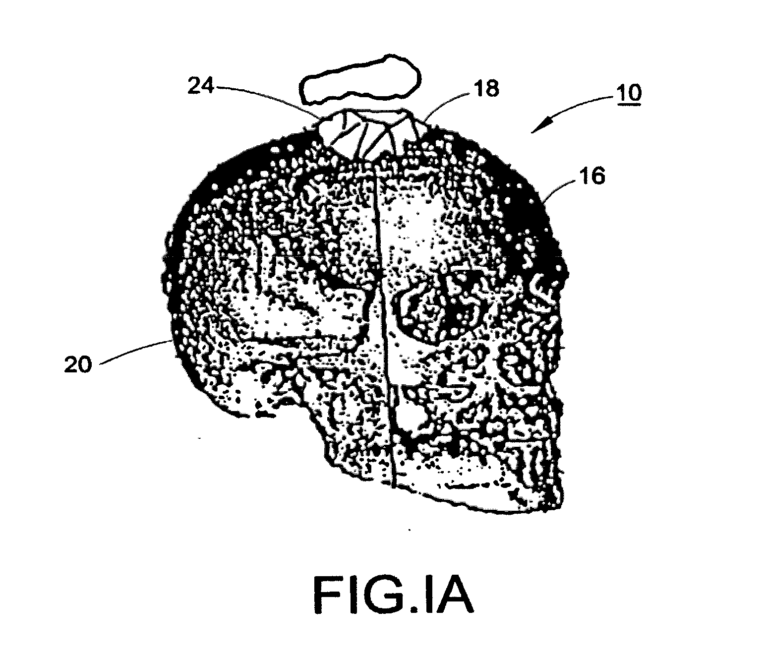 Producing a three dimensional model of an implant