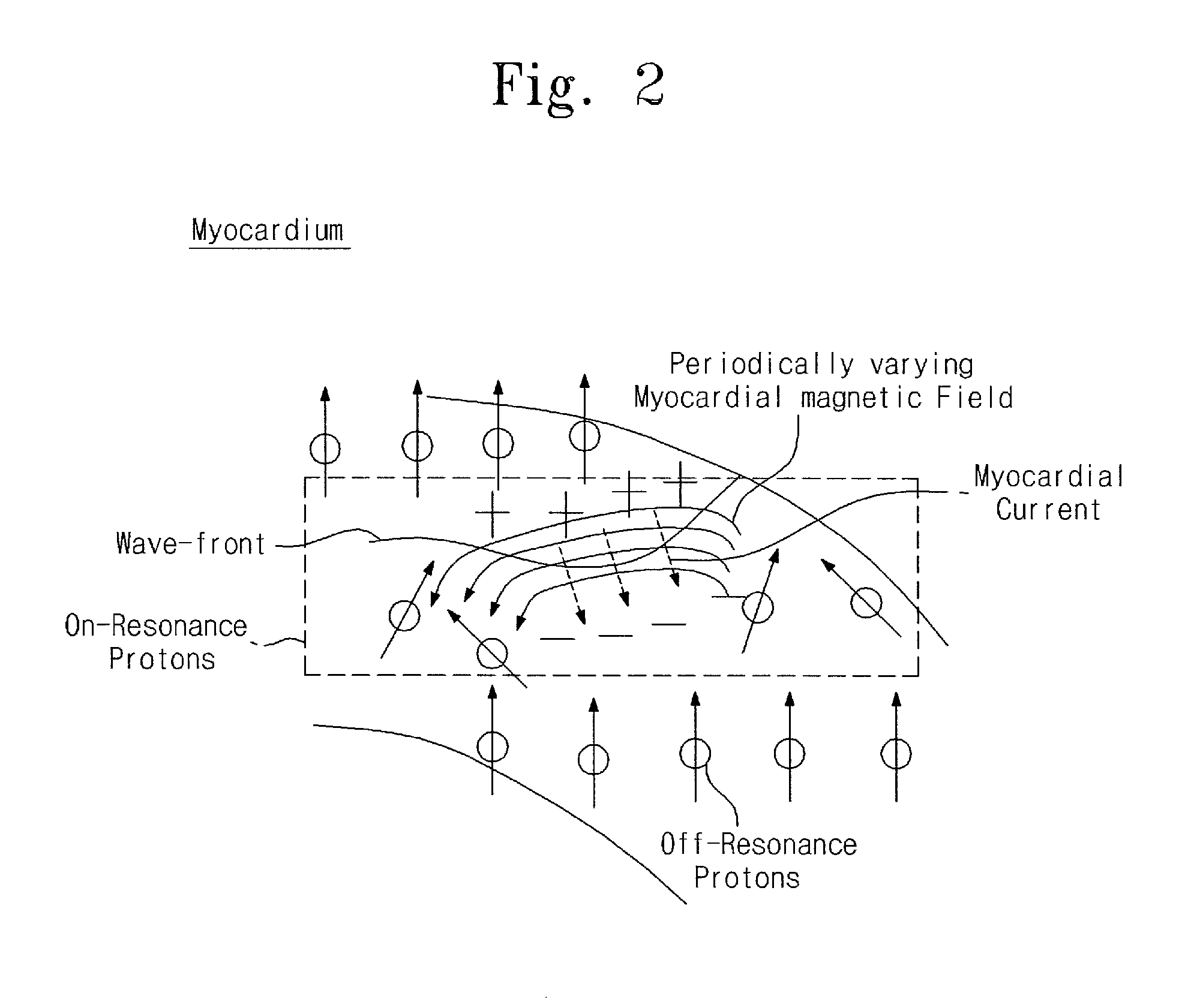 Ultra-low-field nuclear-magnetic-resonance direct myocardial electrical activity detection method and ultra-low-field nuclear-magnetic-resonance device