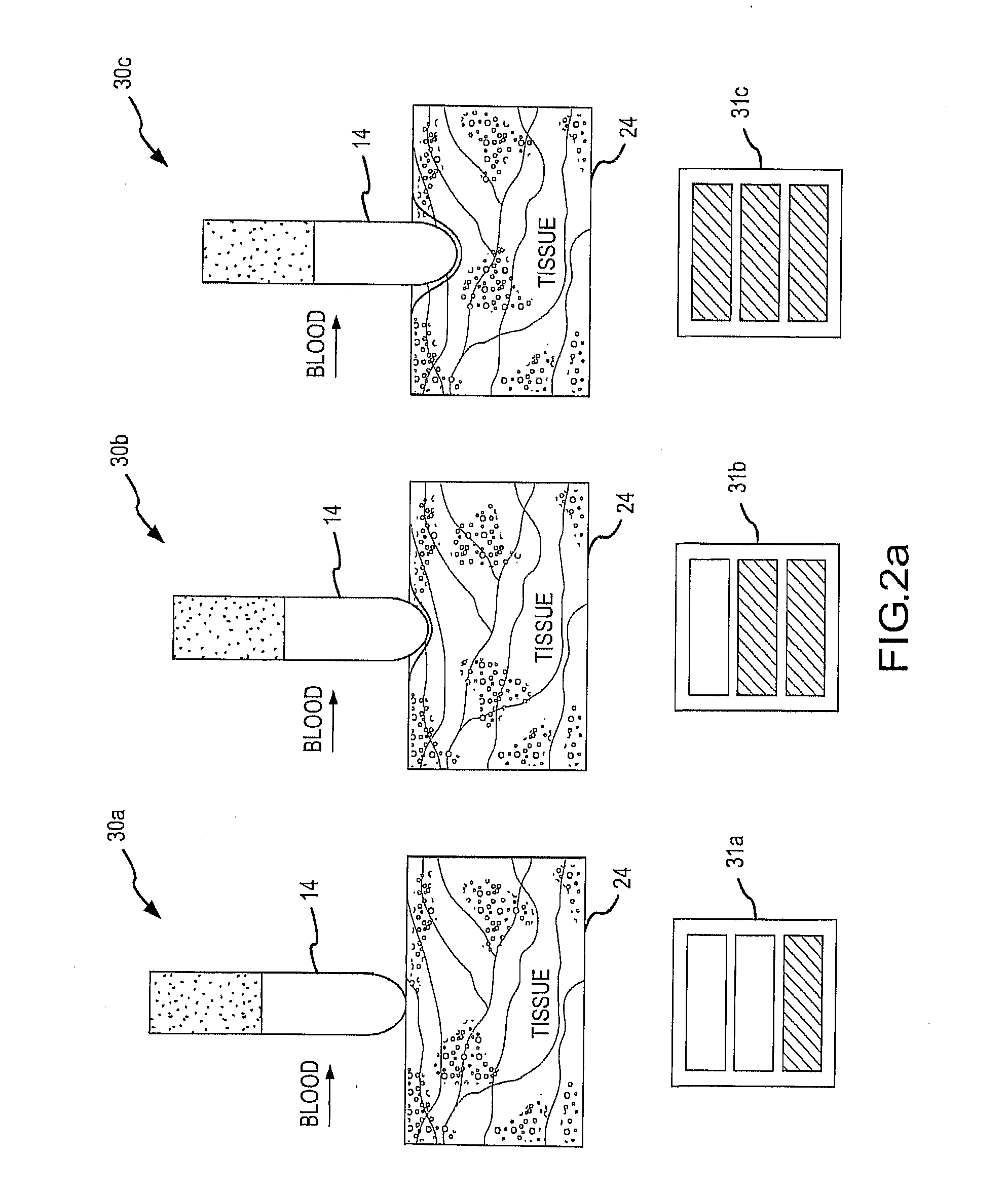 Method for Displaying Catheter Electrode-Tissue Contact in Electro-Anatomic Mapping and Navigation System