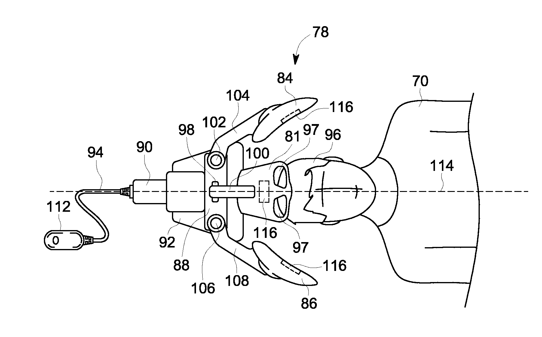 Adjustable MRI head coil apparatus and MRI system