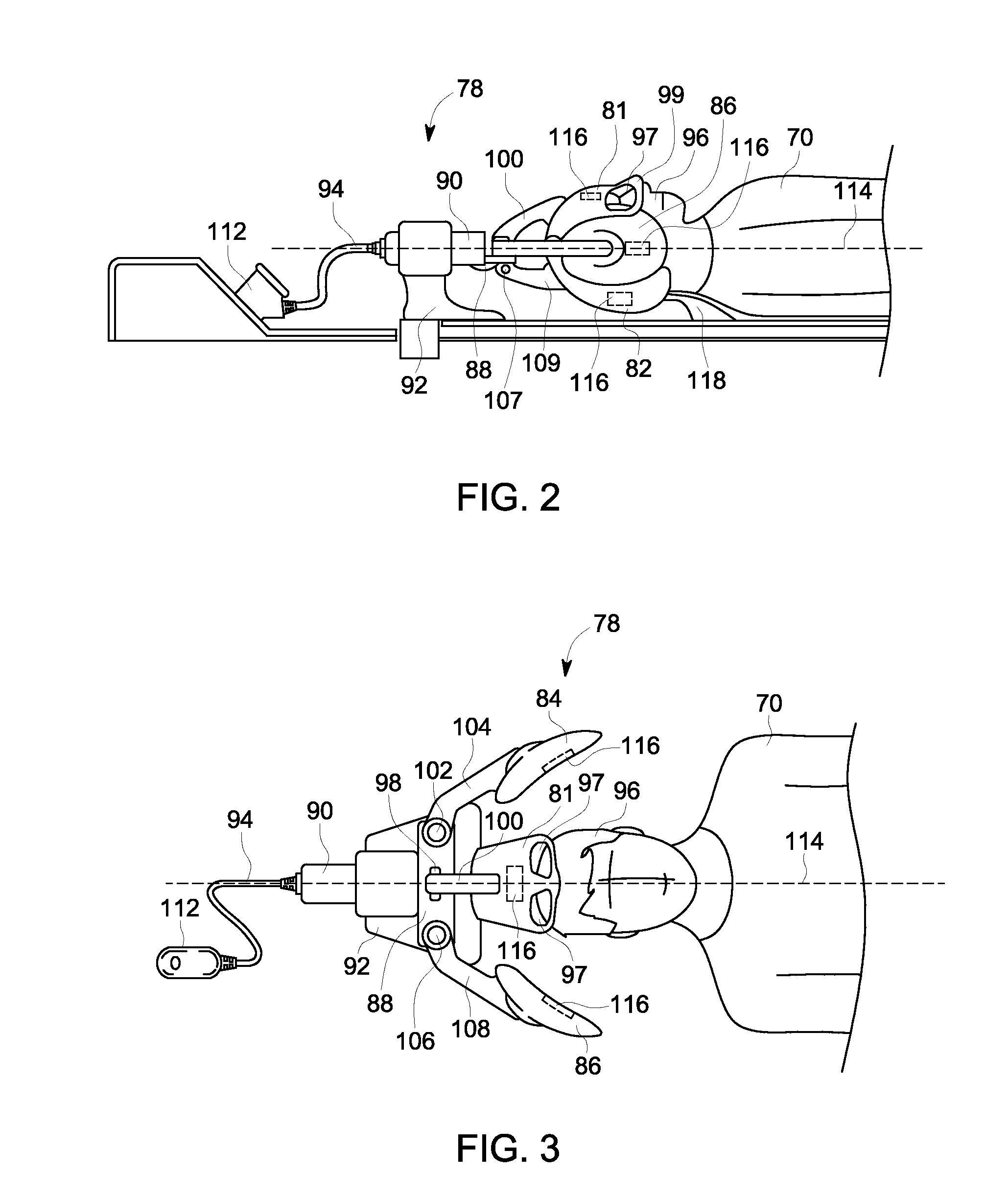 Adjustable MRI head coil apparatus and MRI system