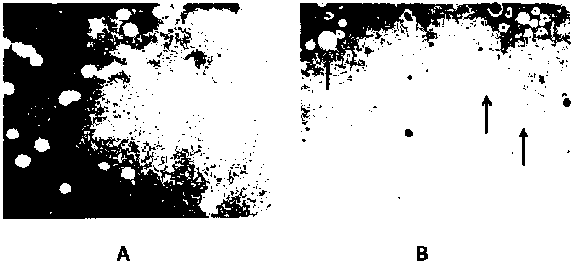 Method for expressing polypeptide