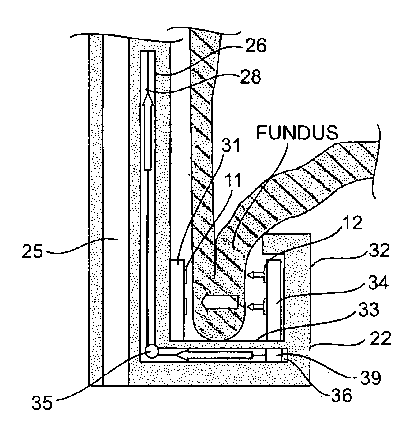 Devices and related methods for securing a tissue fold