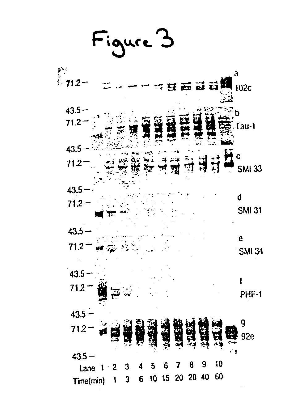 Methods and compositions for treatment and diagnosis of alzheimer disease and other disorders