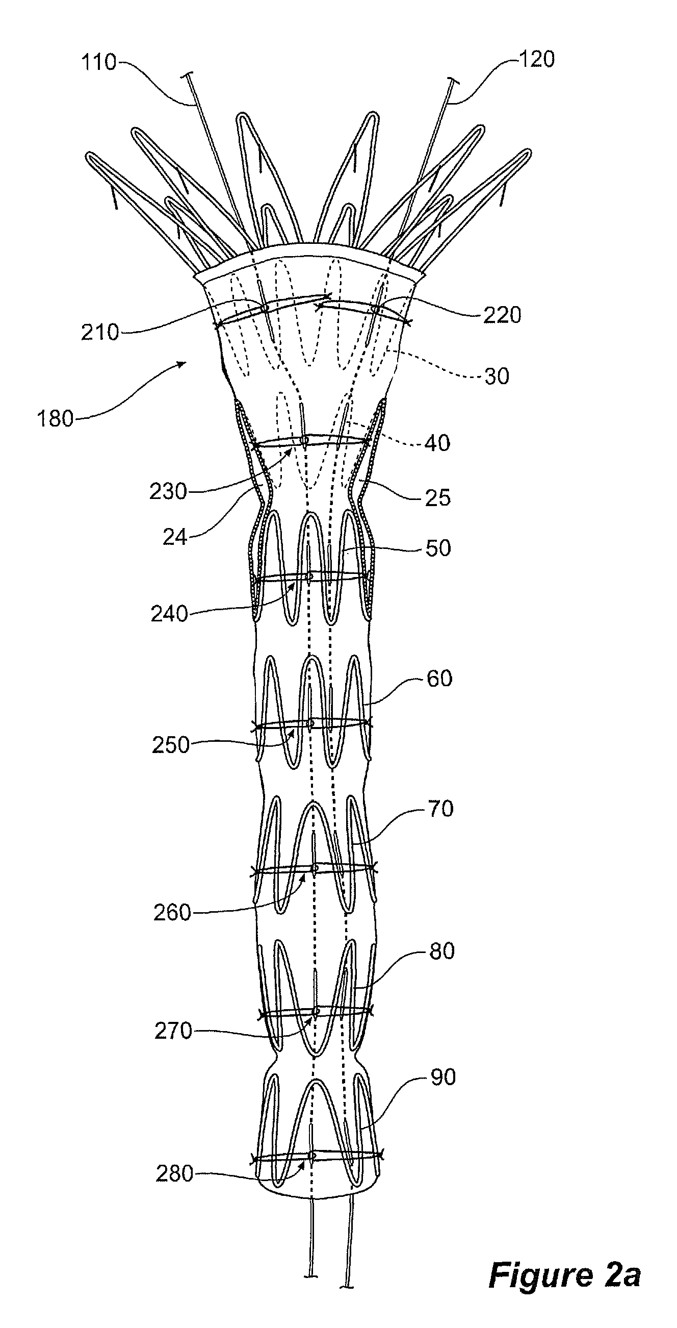 Assembly of stent grafts with diameter reducing ties