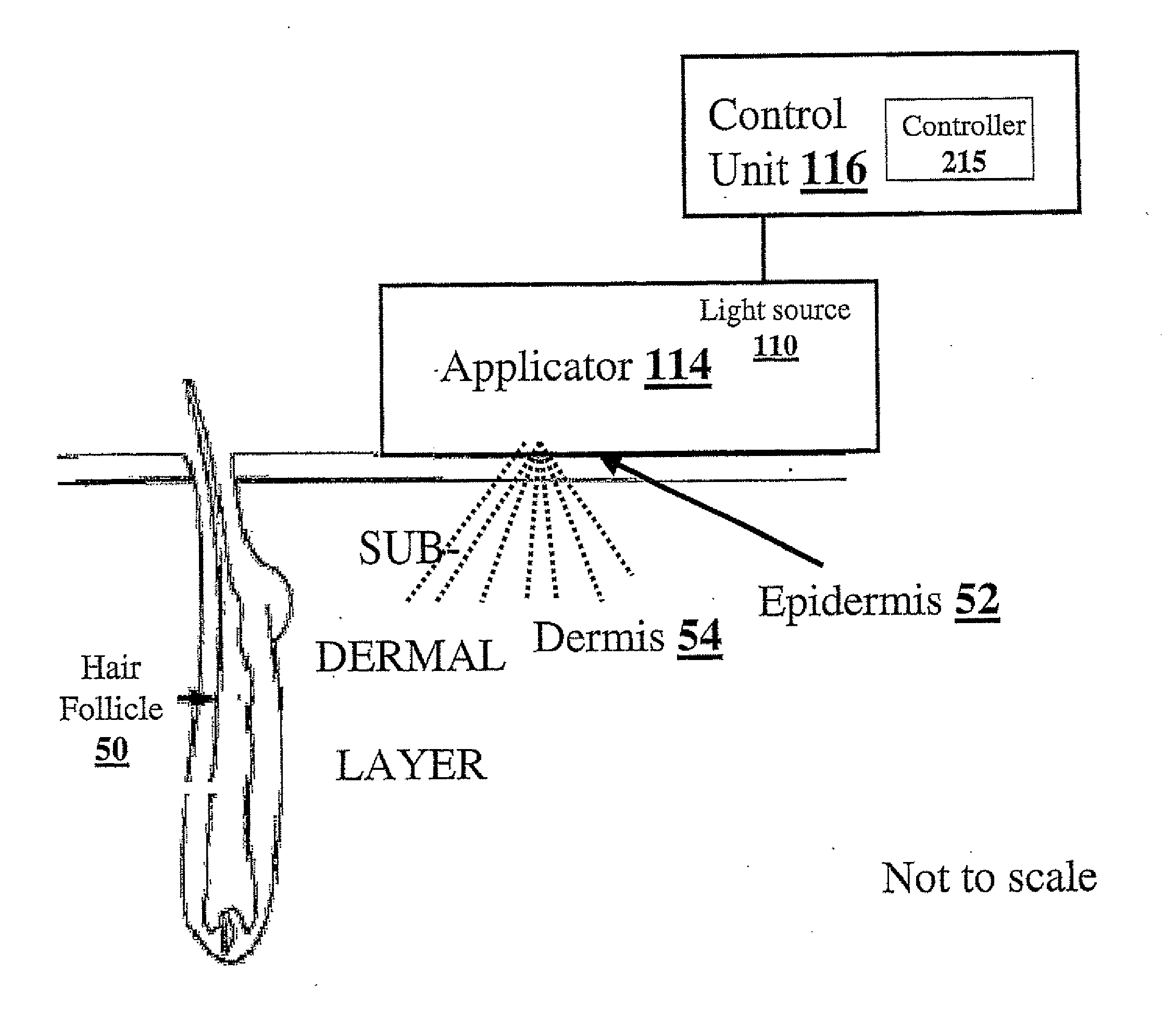 Method and apparatus for light-based hair removal using incoherent light pulses