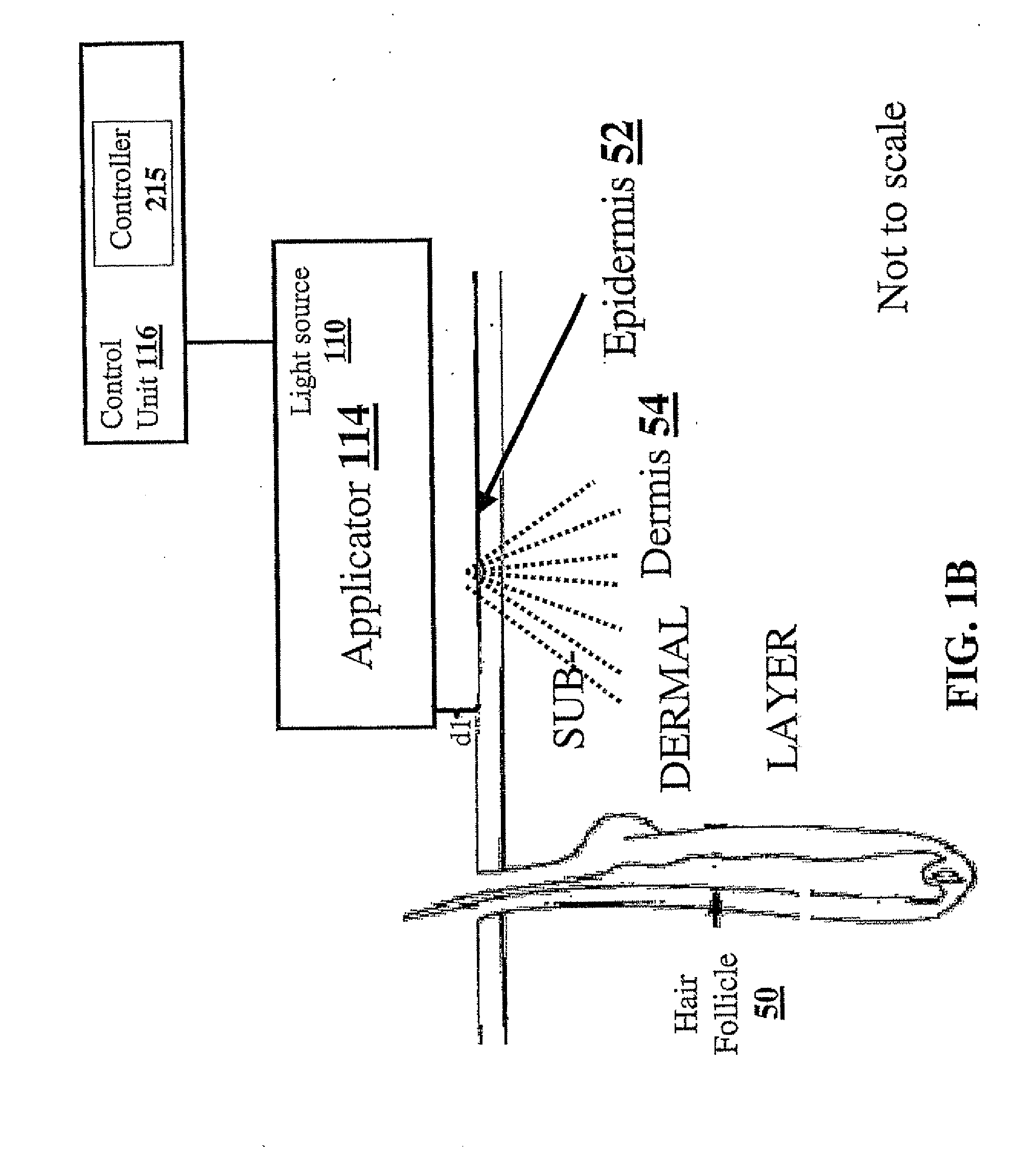 Method and apparatus for light-based hair removal using incoherent light pulses