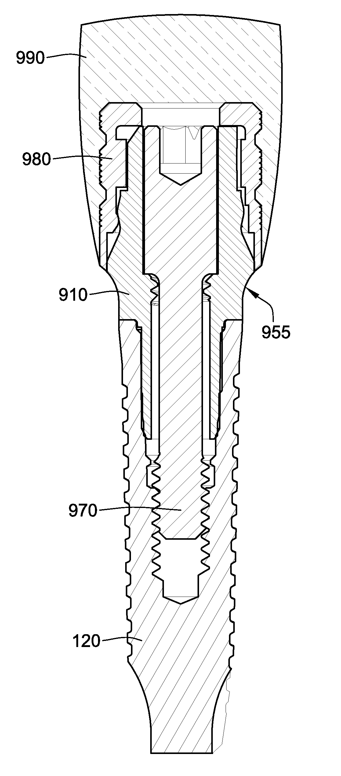 Temporary abutment with combination of scanning features and provisionalization features