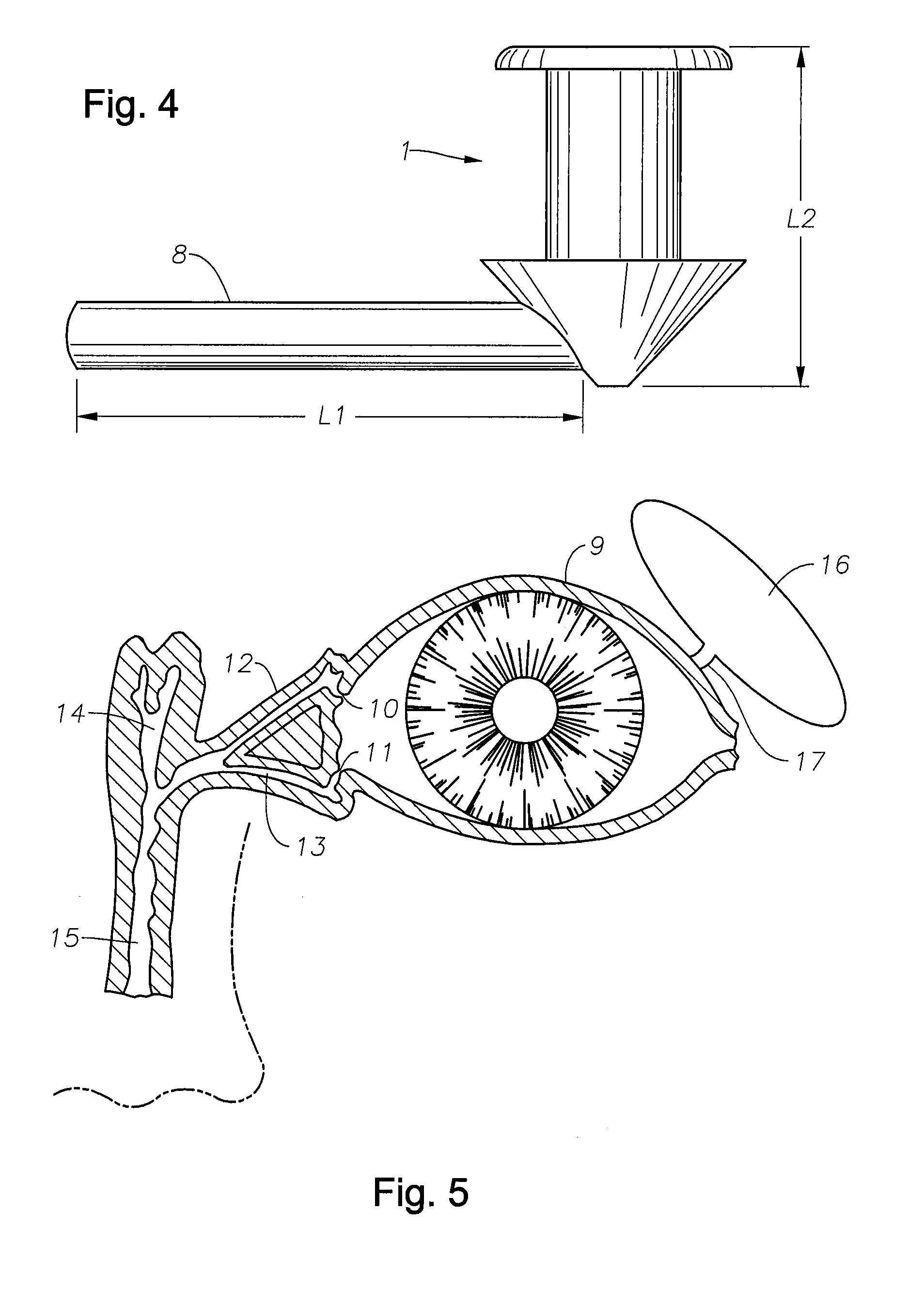 Punctal Plugs and Methods of Delivering Therapeutic Agents