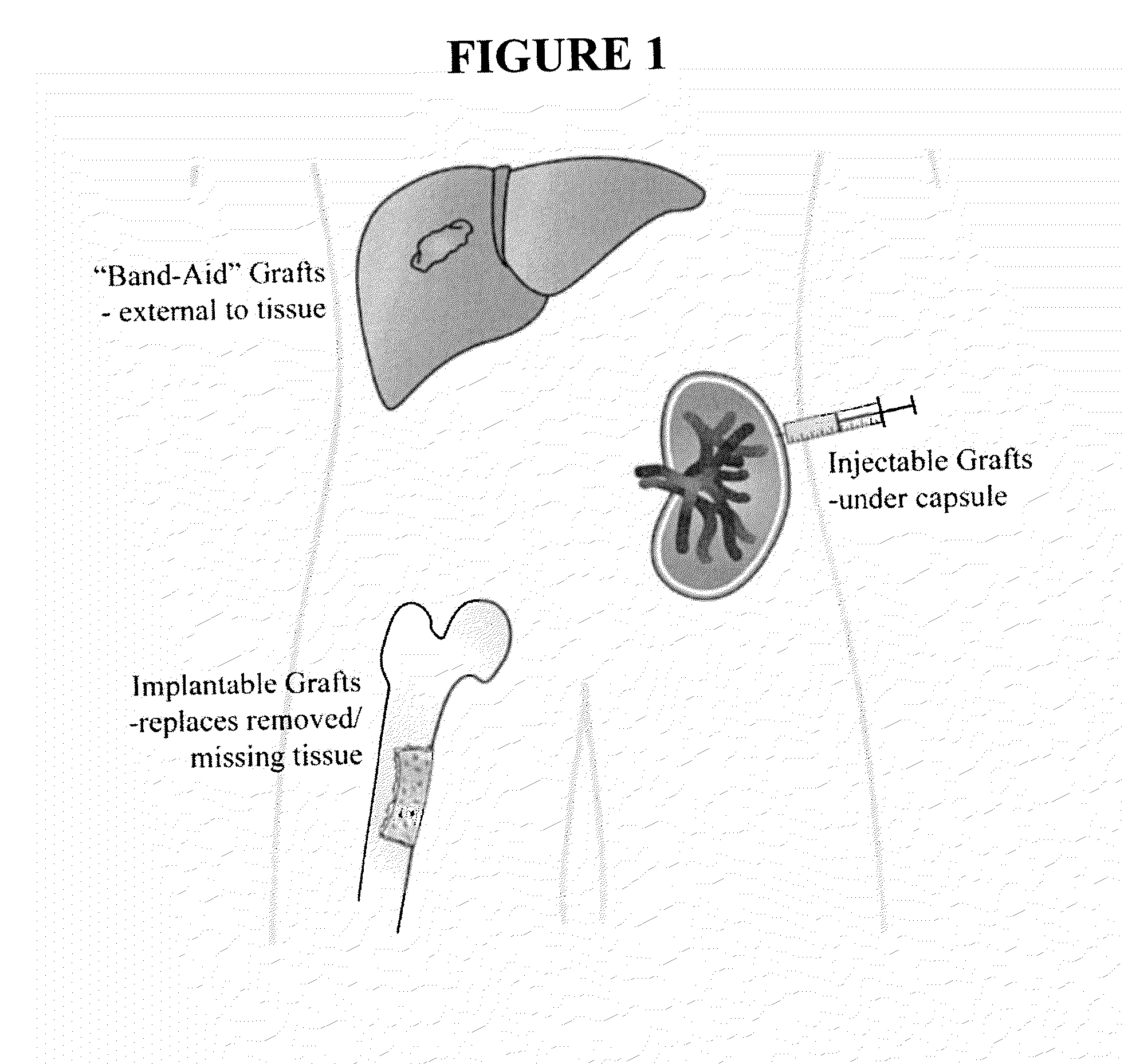 Method of engrafting cells from solid tissues