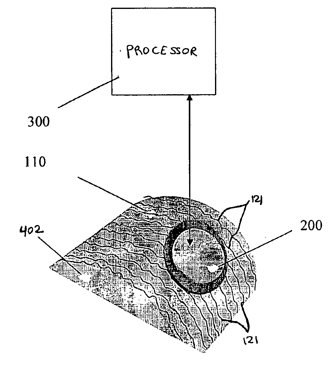System and method for surface acoustic wave treatment of skin