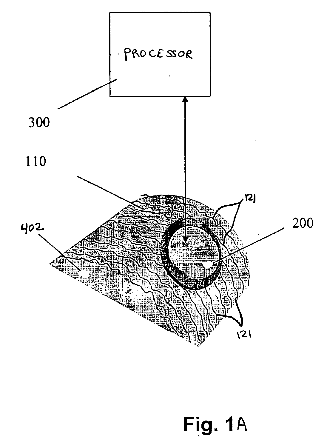 System and method for surface acoustic wave treatment of skin