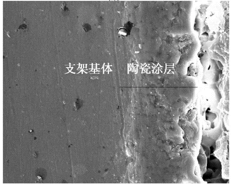 Corrosion-resistant magnesium alloy bracket and preparation method thereof