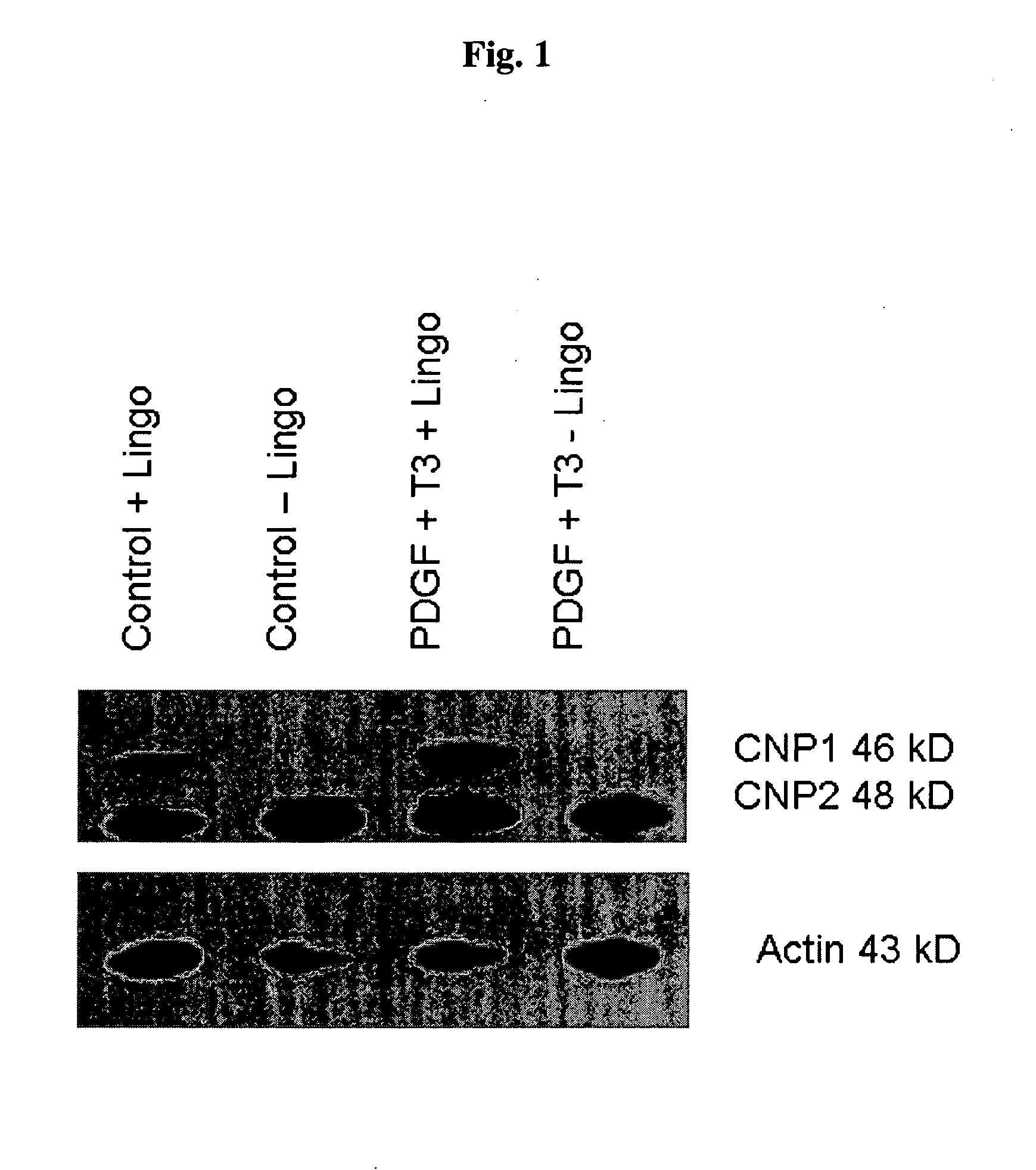 Cell-based compositions and methods for treating conditions of the nervous system