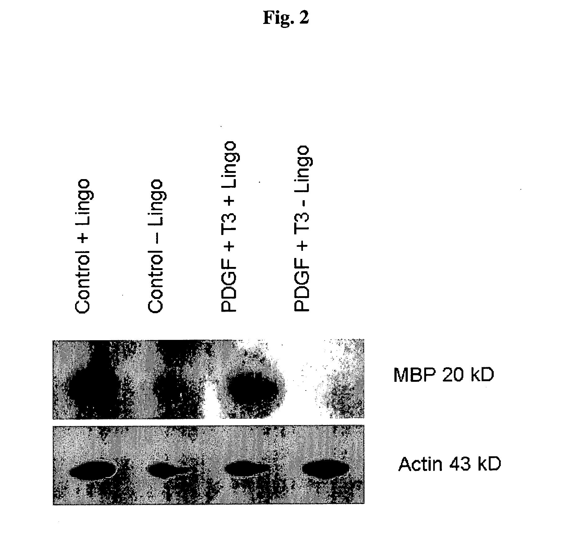 Cell-based compositions and methods for treating conditions of the nervous system