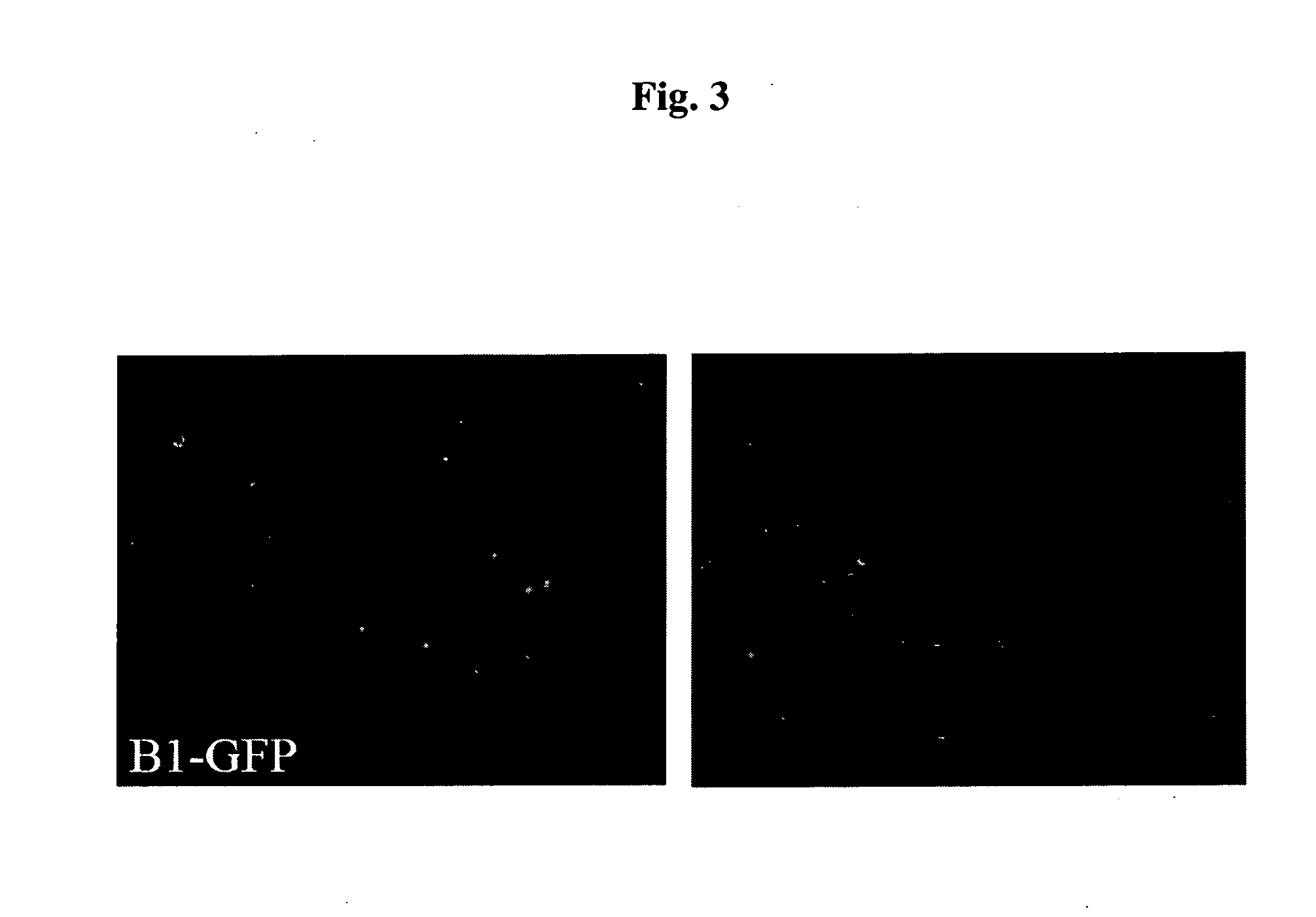 Cell-based compositions and methods for treating conditions of the nervous system