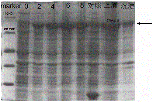 A kind of calcineurin catalytic subunit gene and its application