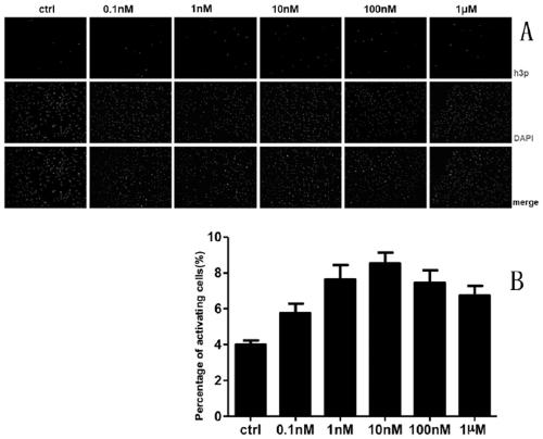 Flavone derivative and preparation method and medical application of flavone derivative