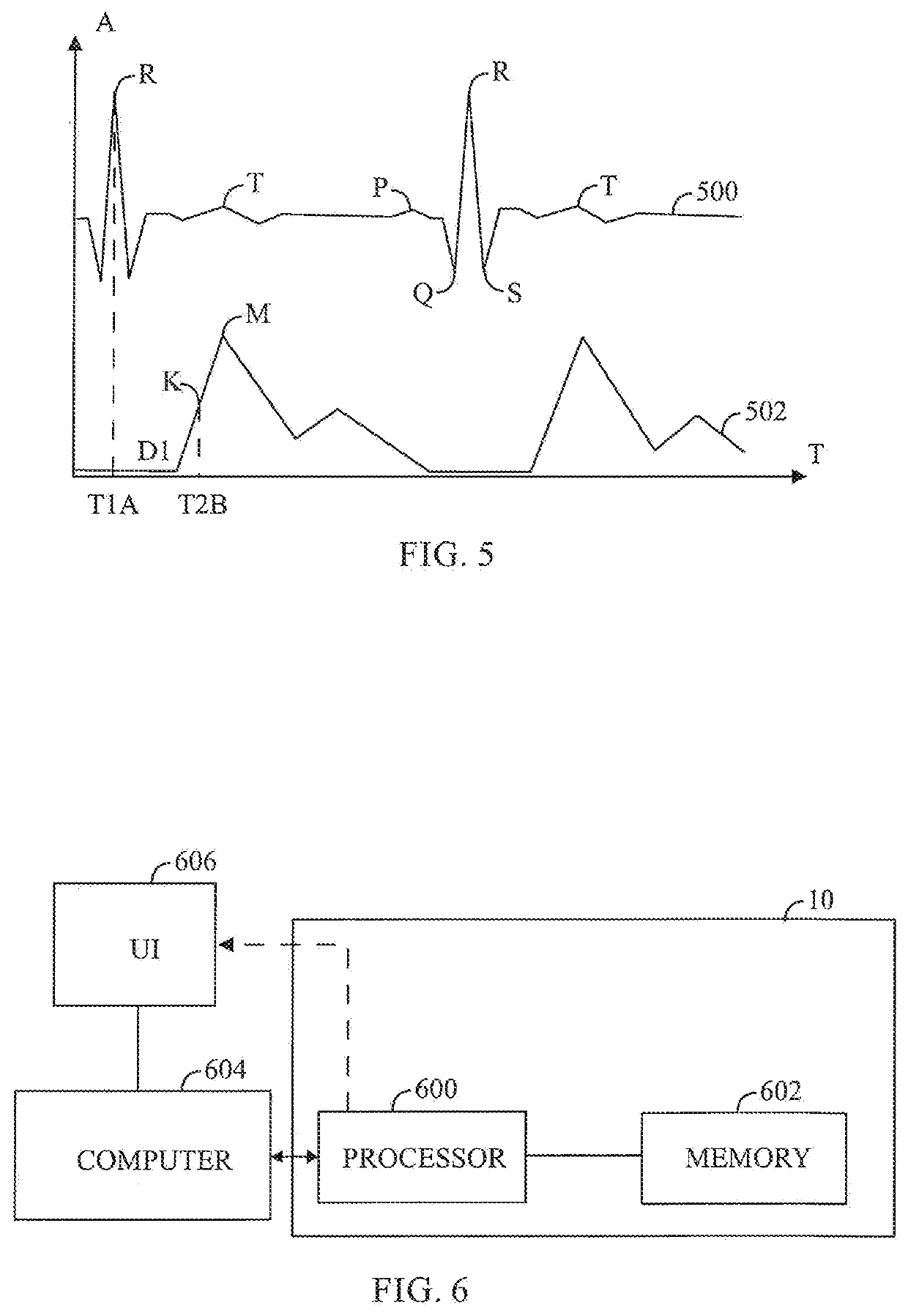 Biosignal measurement apparatus and method