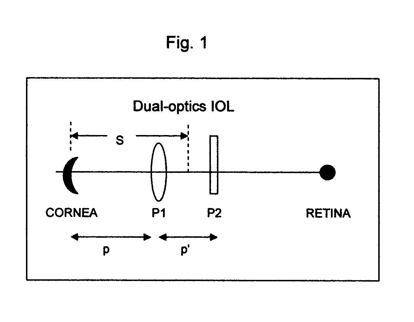 Method and device for vision correction via dual-optics accommodating intraocular lens