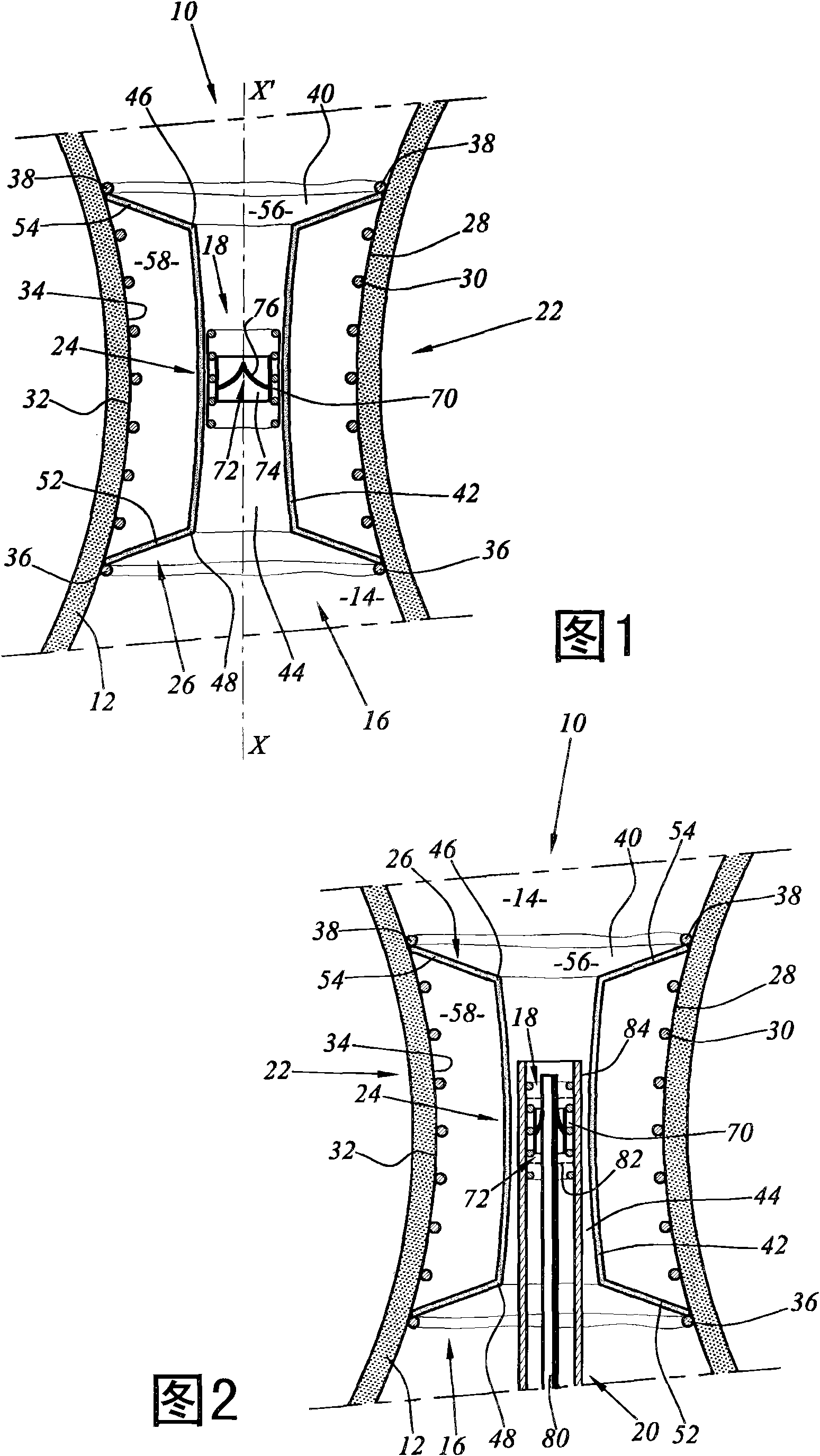 Kit for processing a blood circulation pipe