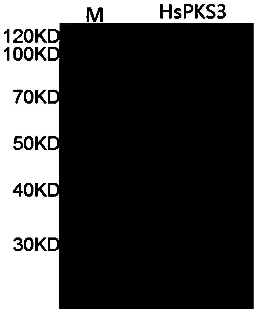 Method for synthesizing quinolizine ketone compounds by enzyme method