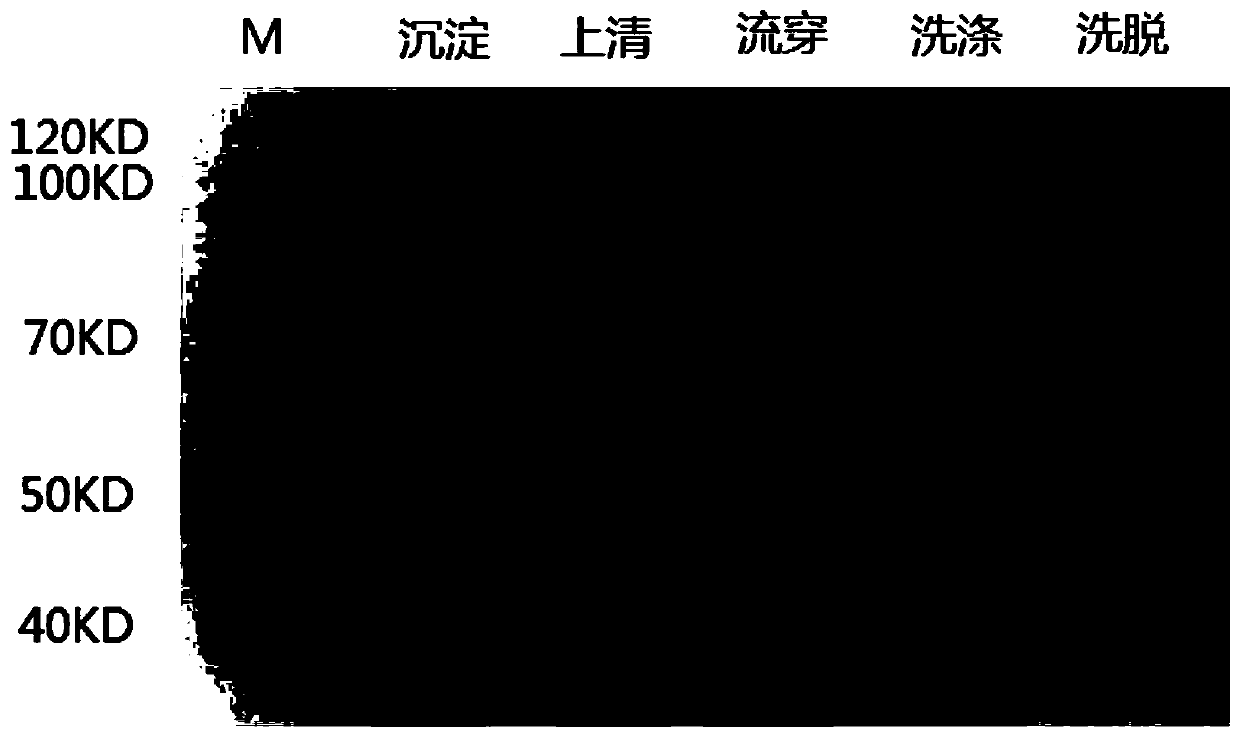 Method for synthesizing quinolizine ketone compounds by enzyme method