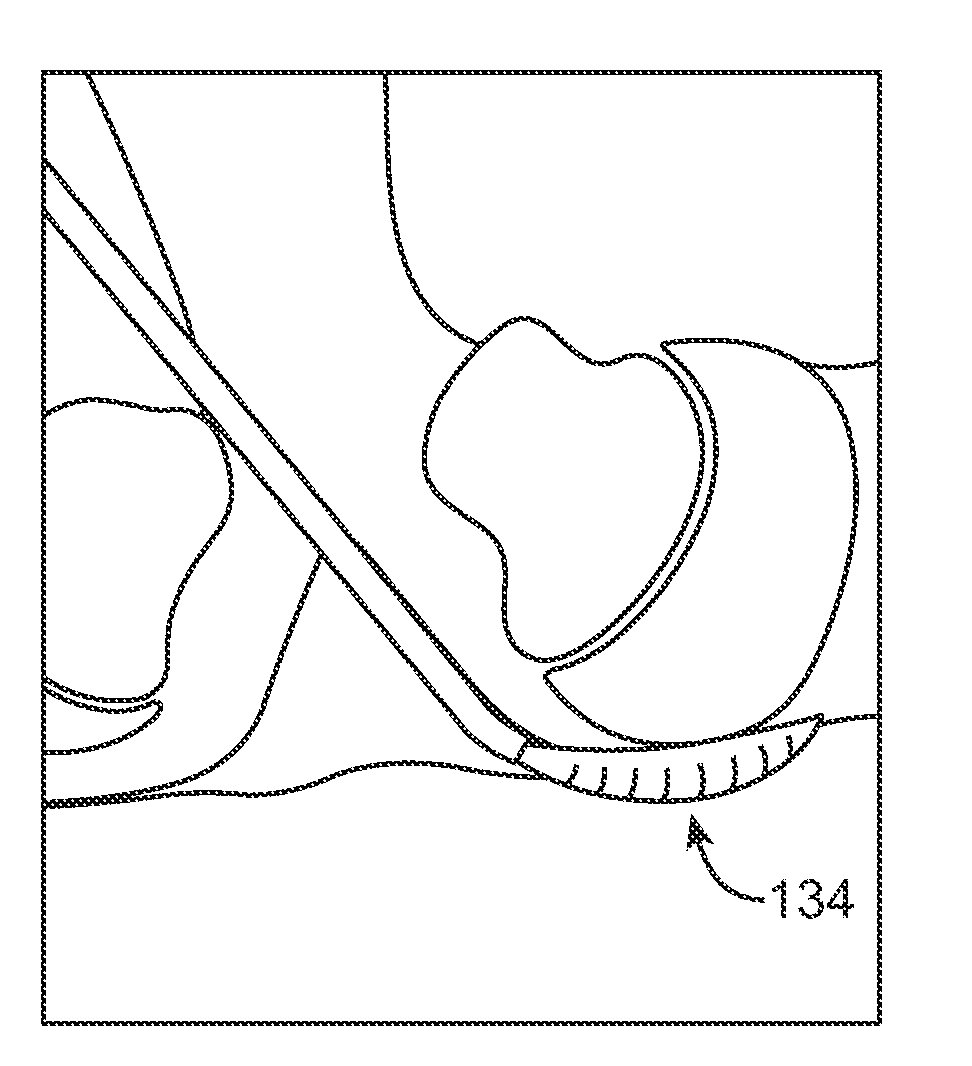 Devices and methods for tissue access