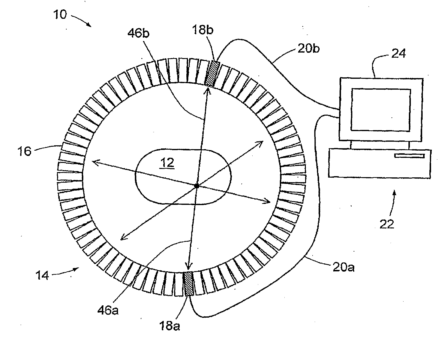 Radiation imaging method with individual signal resolution