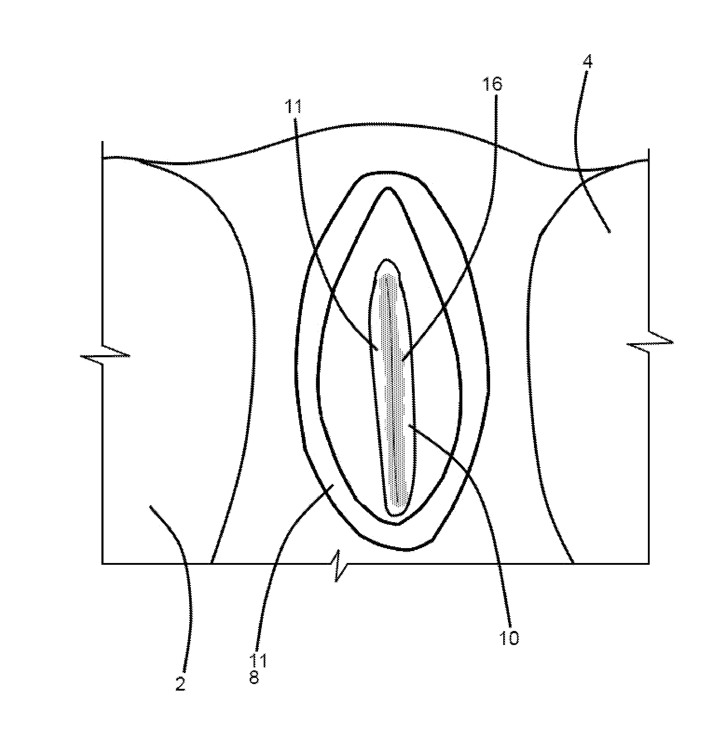 Method for alternatively resisting and permitting menstrual flow