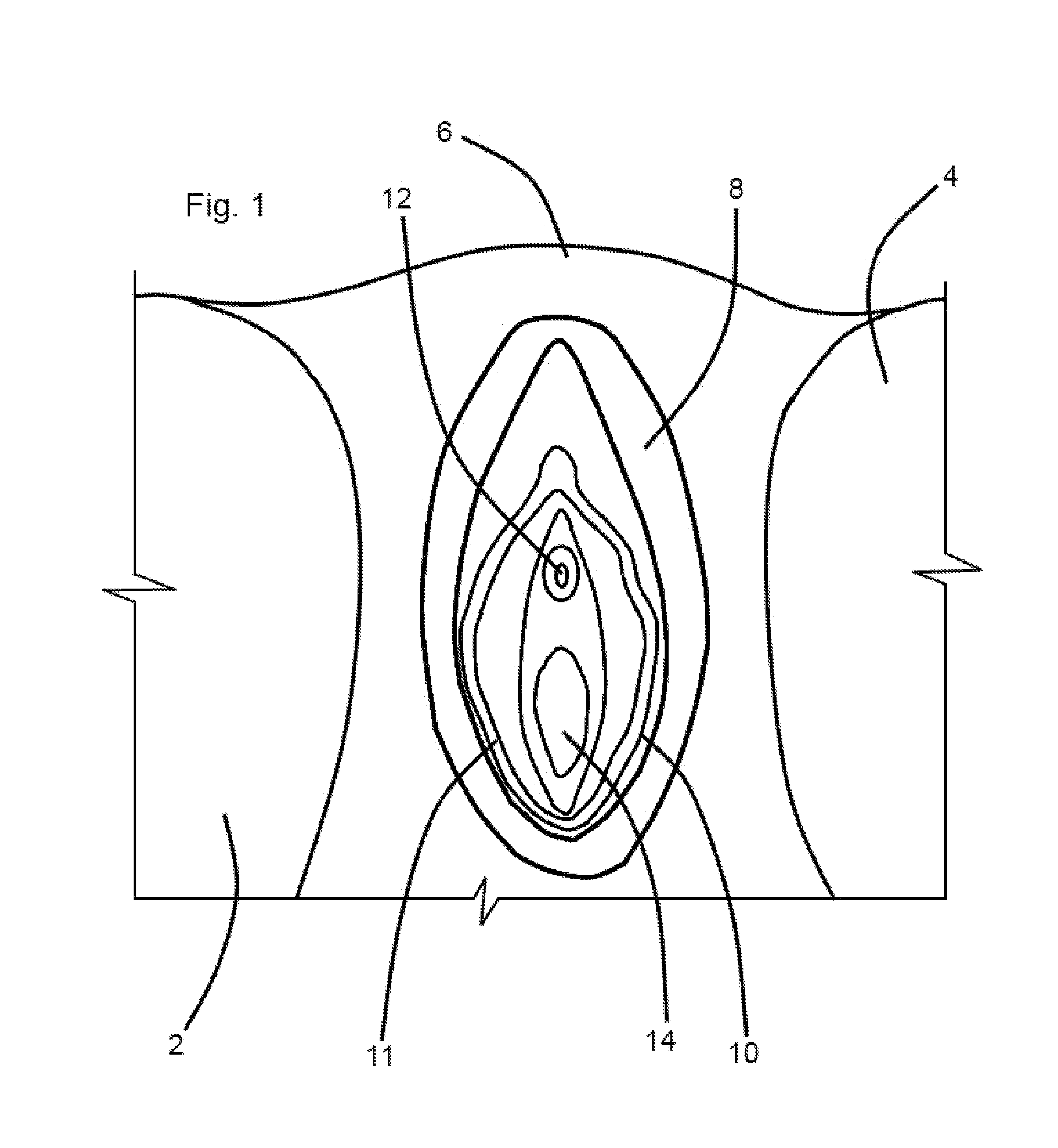 Method for alternatively resisting and permitting menstrual flow