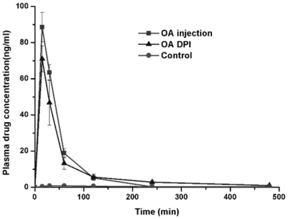 Octreotide acetate dry powder inhalation preparation and preparation method thereof