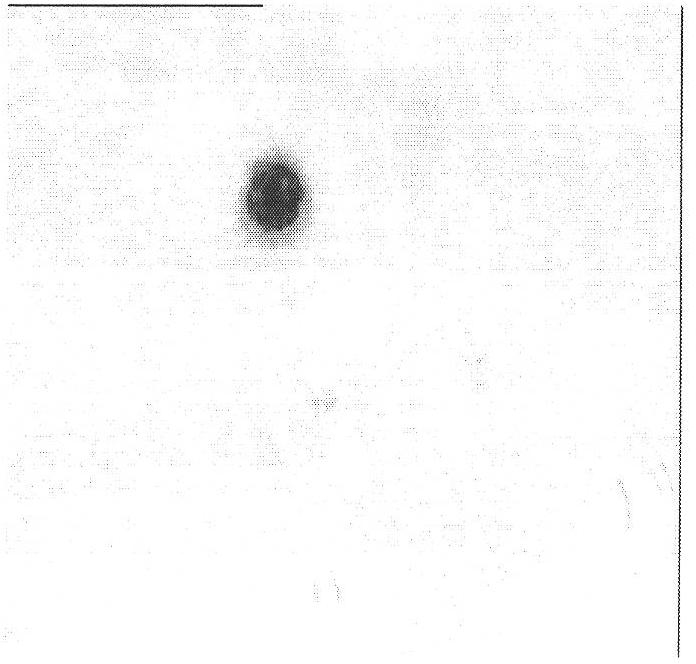 Analytical method of nuclear texture of peripheral blood mononuclear cell