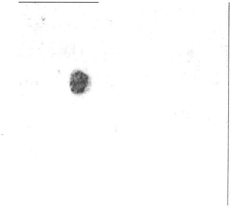 Analytical method of nuclear texture of peripheral blood mononuclear cell