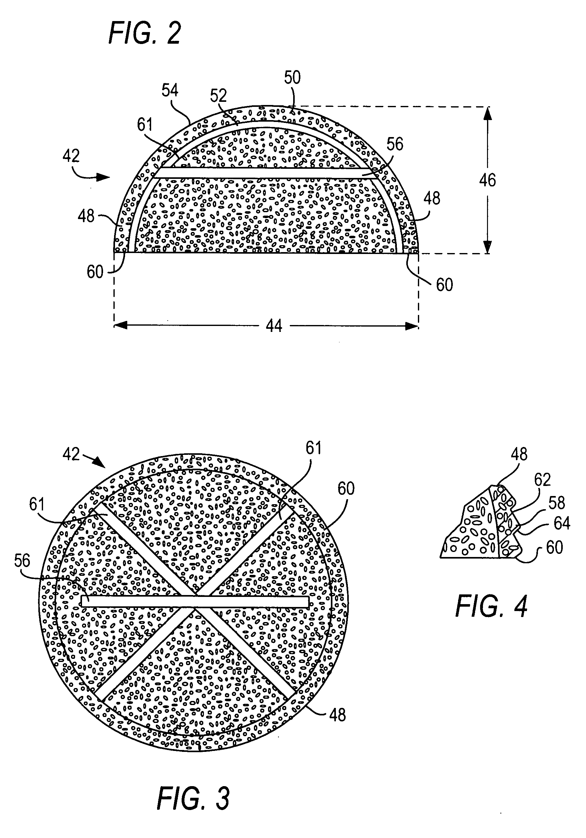 Method and system for intravesicular delivery of therapeutic agents