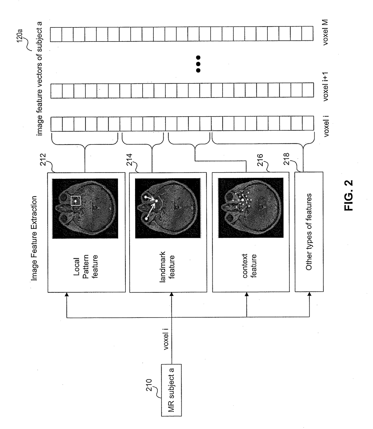 Pseudo-ct generation from mr data using a feature regression model