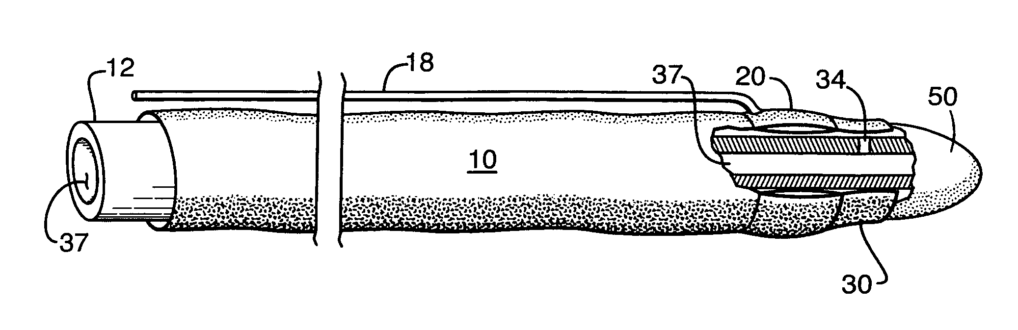 Flaccid tubular membrane and insertion appliance for surgical intubation and method