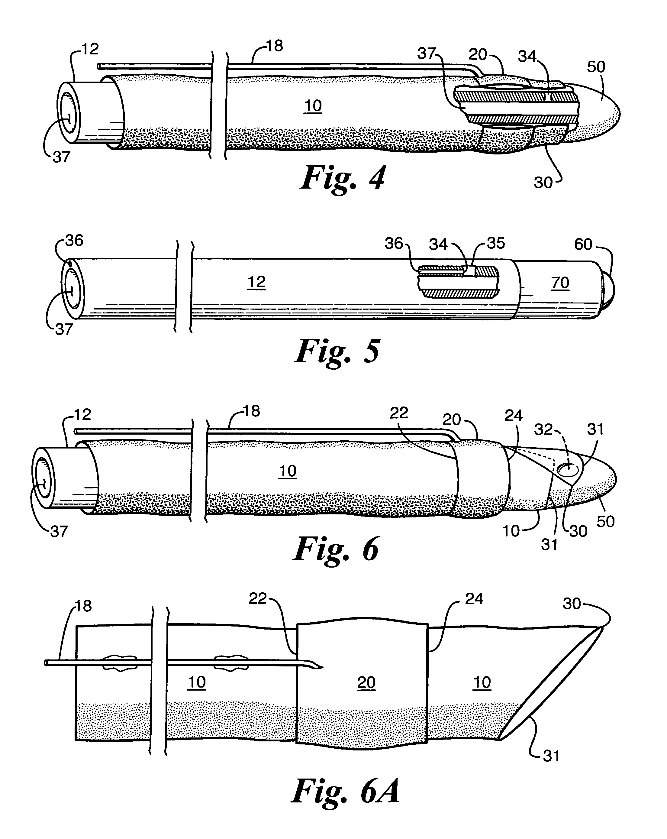 Flaccid tubular membrane and insertion appliance for surgical intubation and method