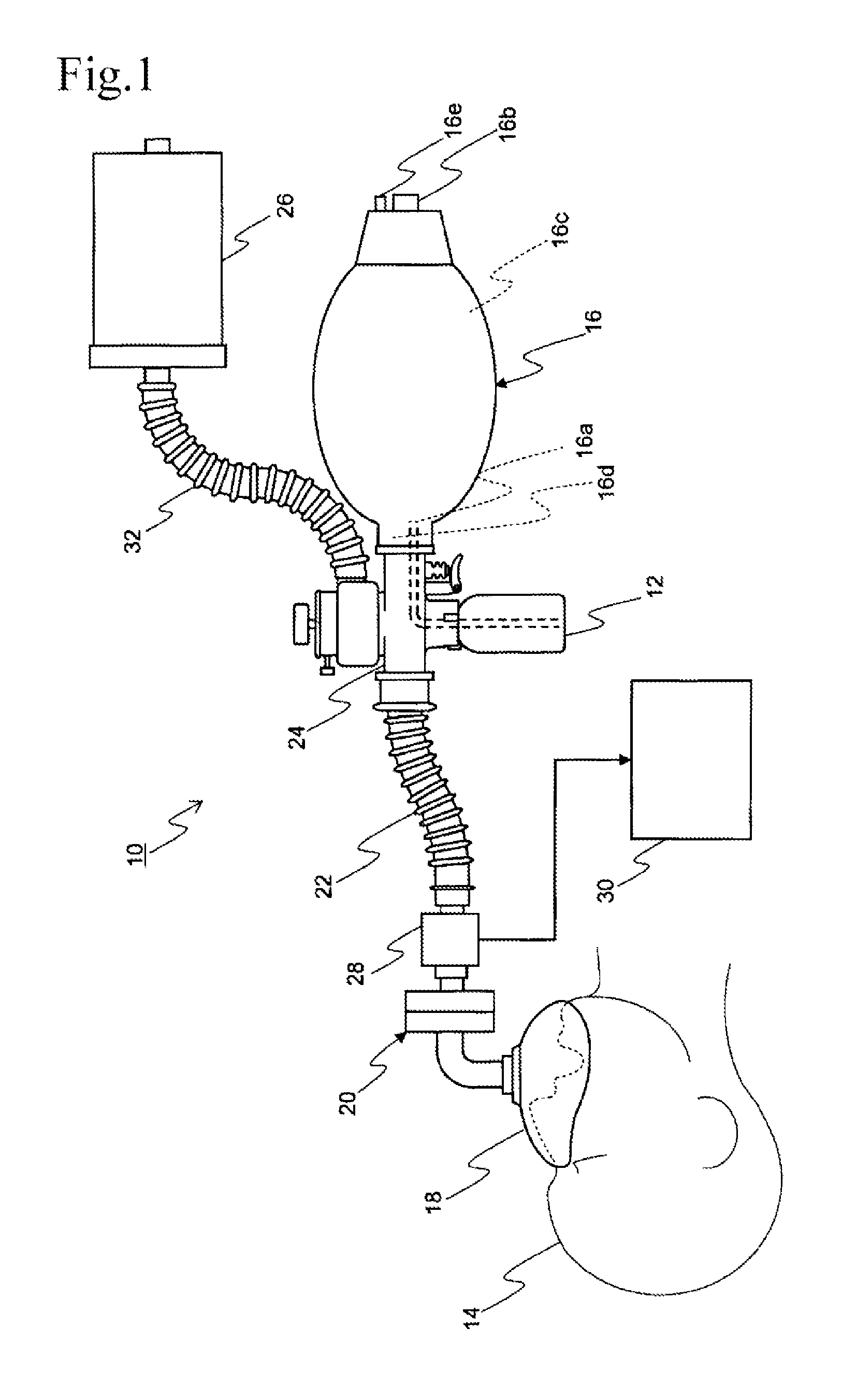 Anesthetic inhalation aid device and attachment used for the same