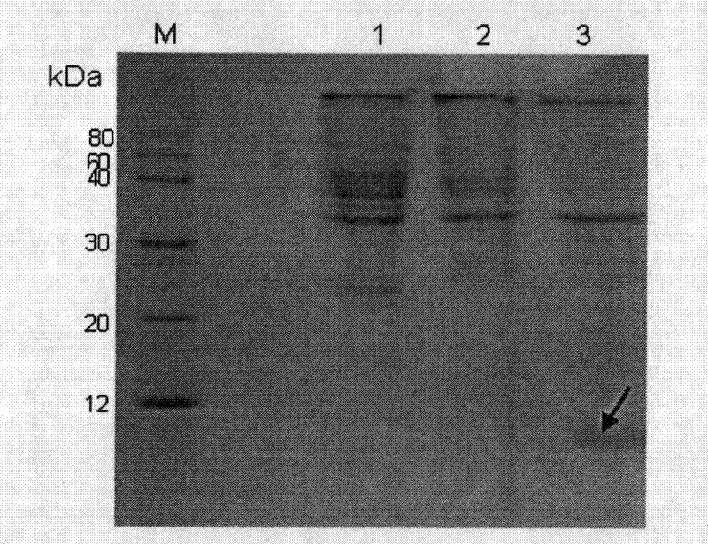 Anti-I type Shiga toxin IgY antibody as well as preparation method and use thereof