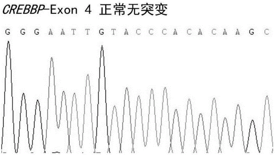 ALL prognostic related gene mutation detection method, primers and kit