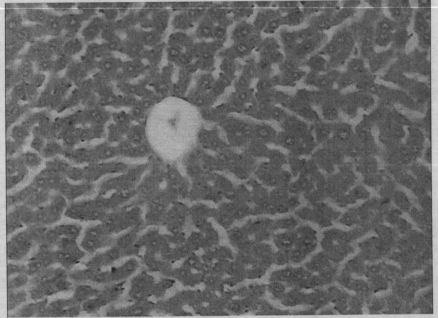 Antitubercular pharmaceutical composition containing balloonflower root extract