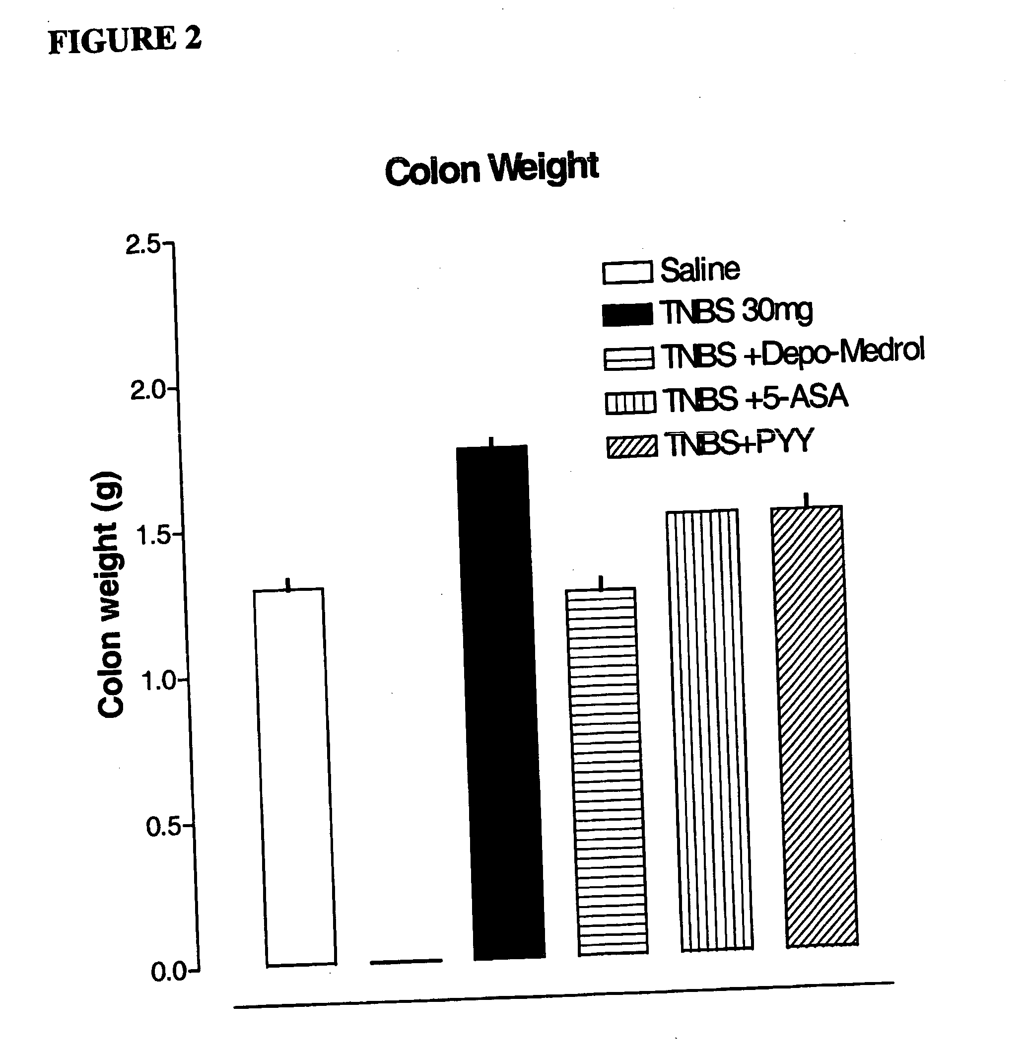 Prevention and/or treatment of inflammatory bowel disease using pyy or agonists thereof