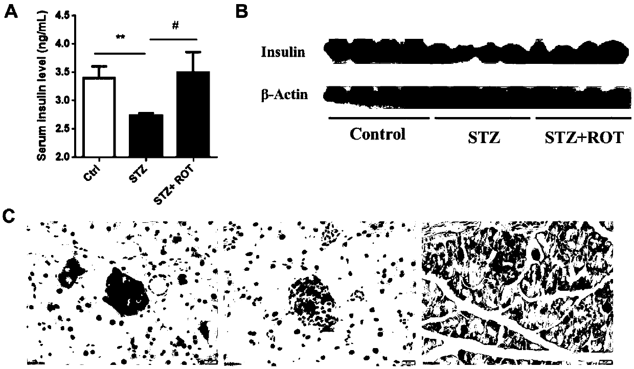 Application of rotenone in islet protection