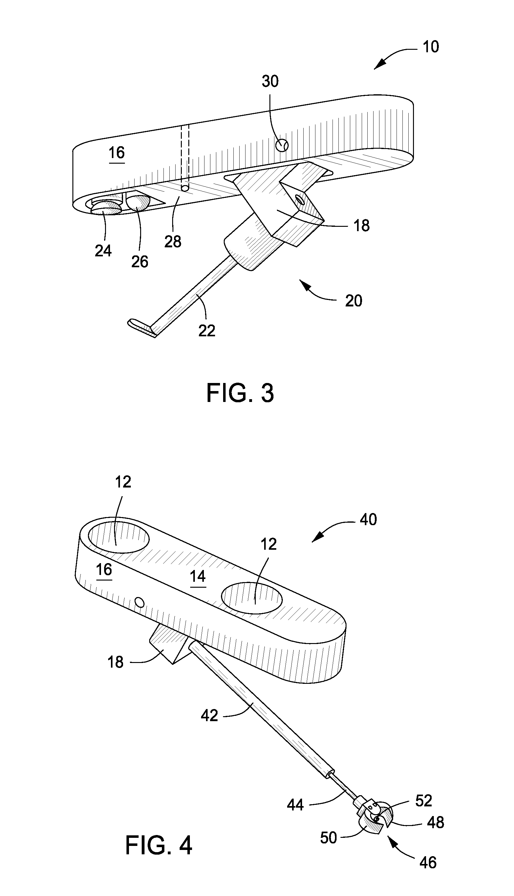 Devices for use in transluminal and endoluminal surgery
