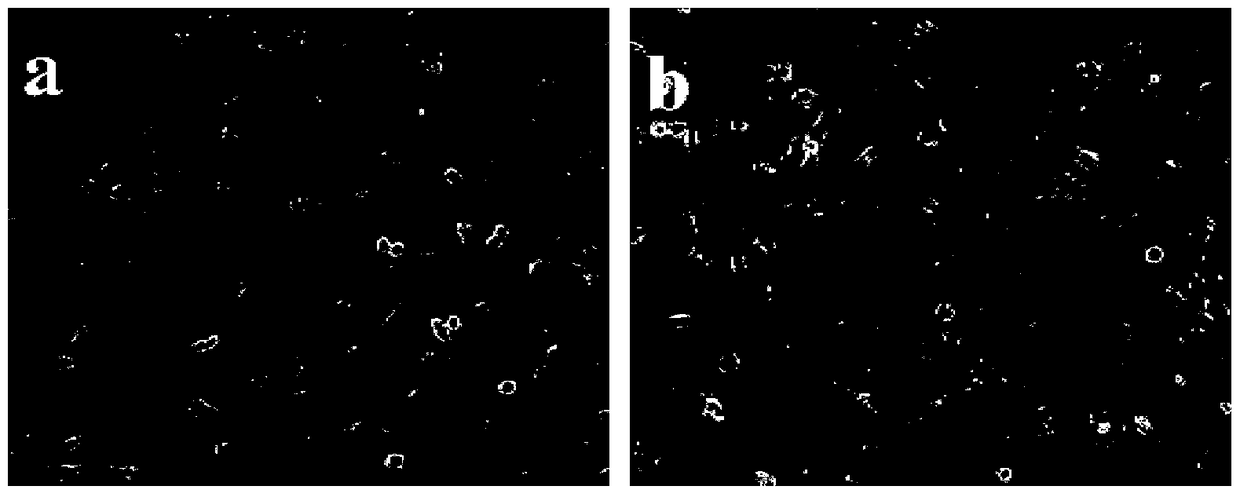 A kind of preparation method of double-layer structure corneal repair material