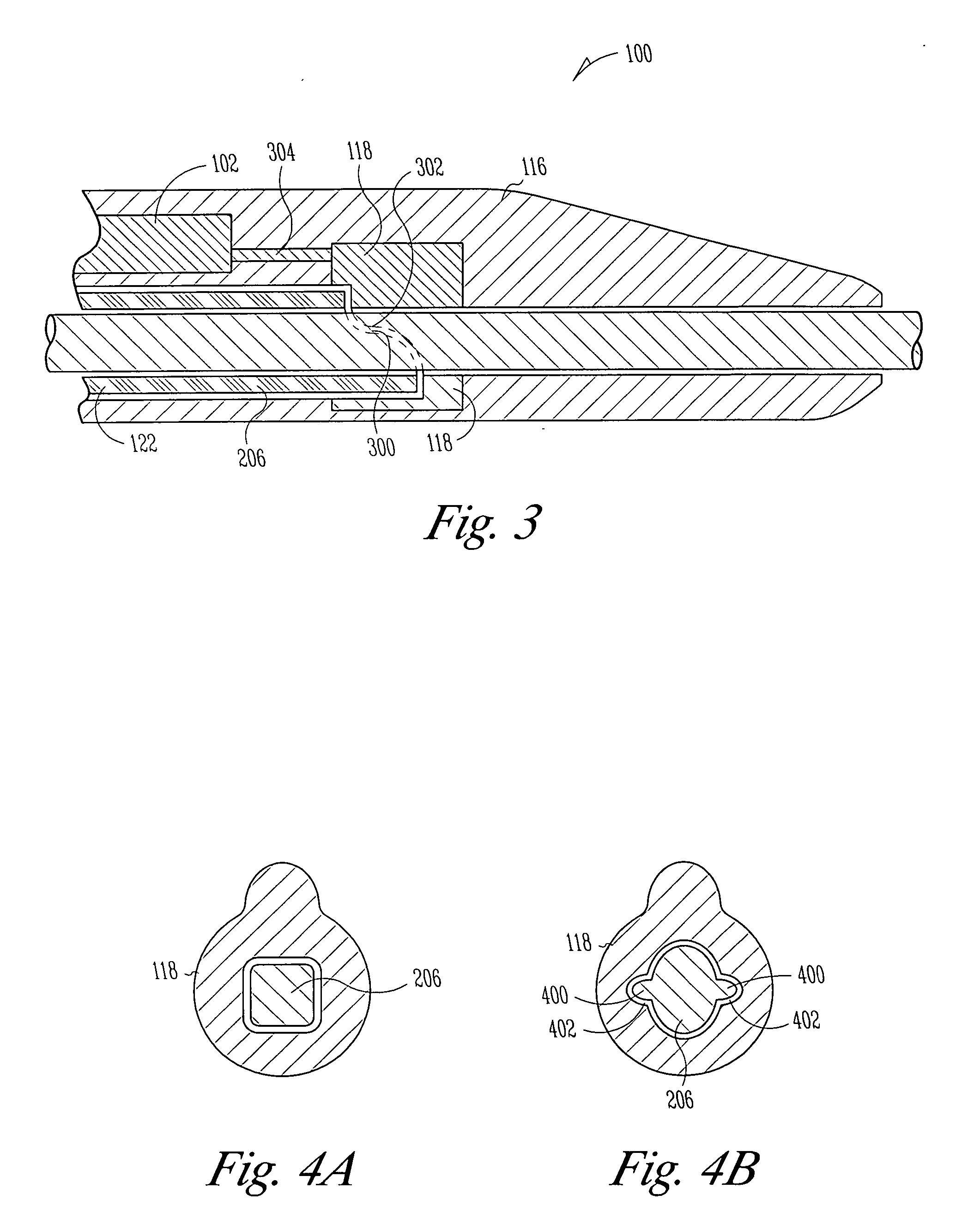 Lead assembly and methods including a push tube